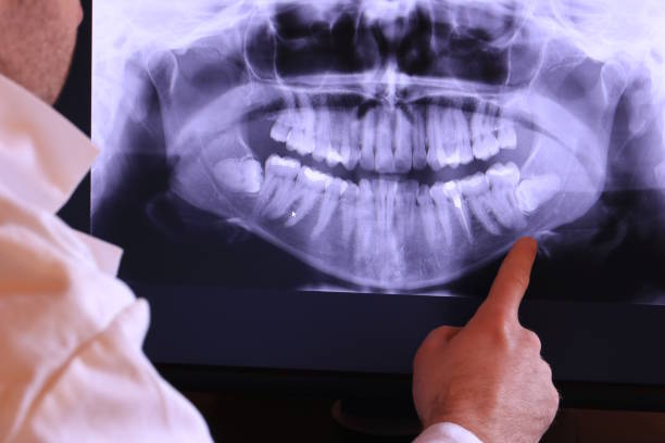 Best Emergency TMJ Treatment in Oakley, UT